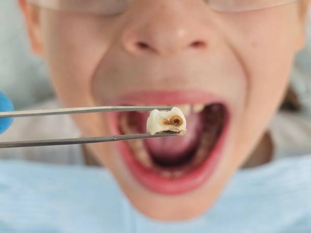Best Emergency Orthodontic Repairs in Albers, IL